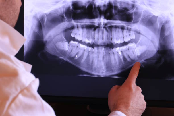 Best Emergency Wisdom Tooth Extraction in Norlina, NC