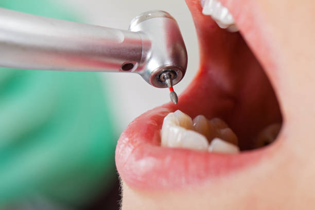 Best Emergency Dental Care for Sports Injuries in Norlina, NC